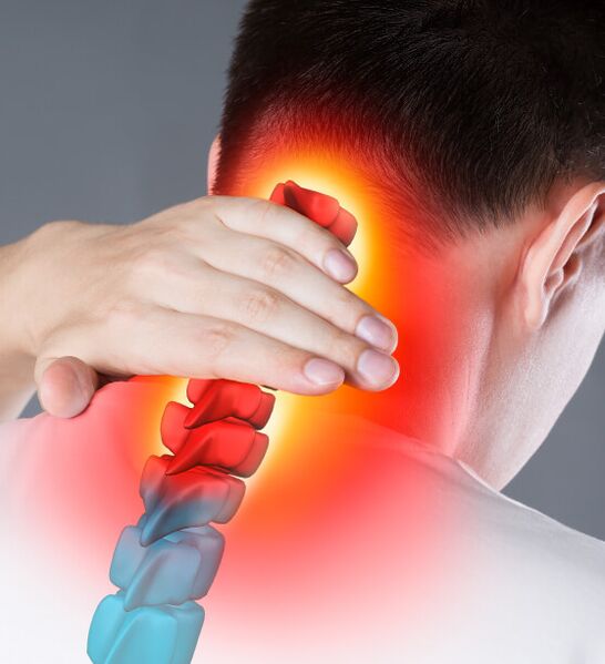 Sintomi di osteocondosi cervicale