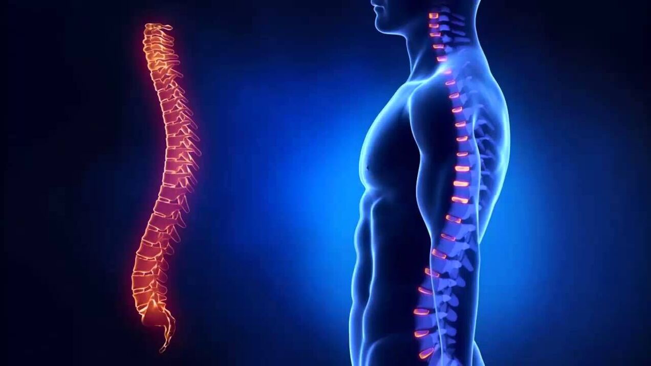 L'osteocondrosi viene classificata in base alle parti della colonna vertebrale in cui si sviluppa la malattia.